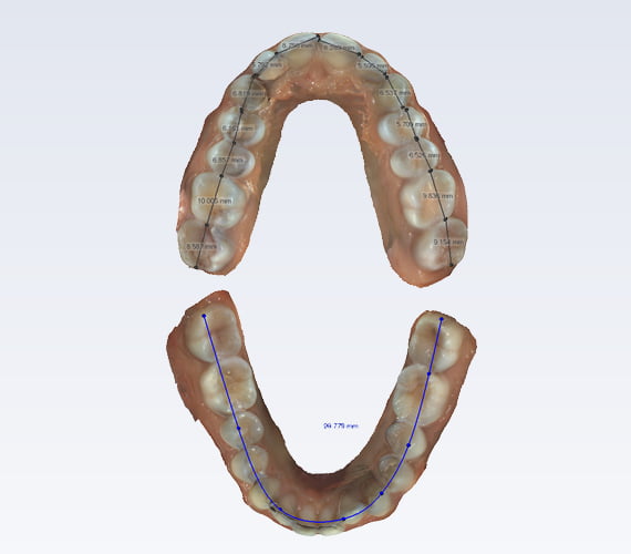 Romexis Model Analyser Unity Stomatologiczne Premium Cbct Rvg